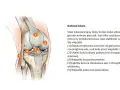 Anatomia kolana: staw otoczony torebką stawową, z widocznymi więzadłami i chrząstkami.