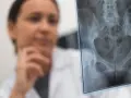 Lekarka analizuje RTG miednicy, szukając śladów stłuczenia biodra po upadku.