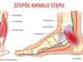 Ilustracja pokazuje anatomię stopy i łydki, z zaznaczonym nerwem piszczelowym. Może pomóc zrozumieć neuropatię i jej objawy.