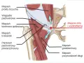 Anatomia pachwiny z zaznaczonym miejscem bólu i uszkodzenia, sugerującym problem z kręgosłupem.
