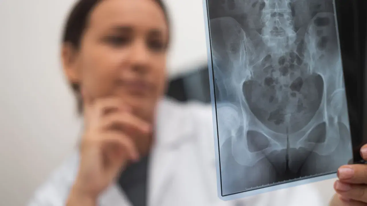 Lekarka analizuje RTG miednicy, szukając śladów stłuczenia biodra po upadku.