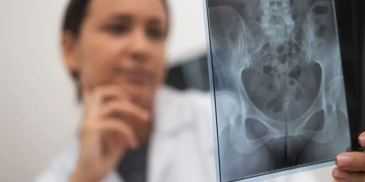 Lekarka analizuje RTG miednicy, szukając śladów stłuczenia biodra po upadku.