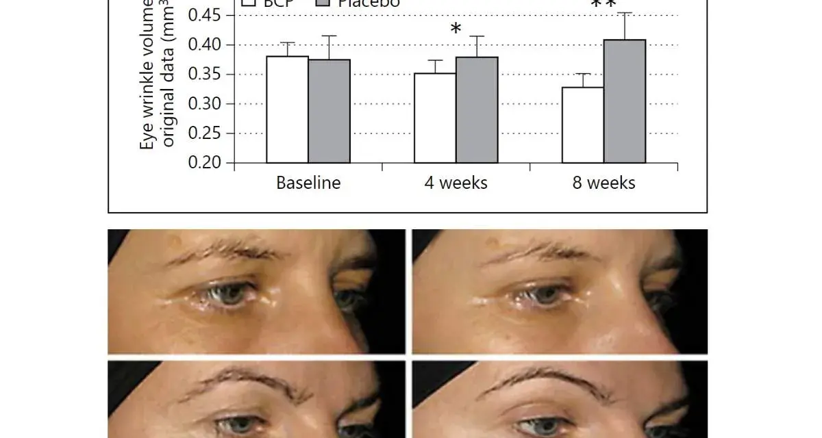 Wykres i zdjęcia pokazują redukcję zmarszczek wokół oczu po 8 tygodniach stosowania premium collagen 5000.