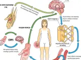 Cykl CRPS: uraz inicjuje ból, który przez rdzeń kręgowy i układ współczulny wywołuje kolejne reakcje, utrwalając ból i obrzęk.