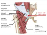 Anatomia pachwiny z zaznaczonym miejscem bólu i uszkodzenia, sugerującym problem z kręgosłupem.