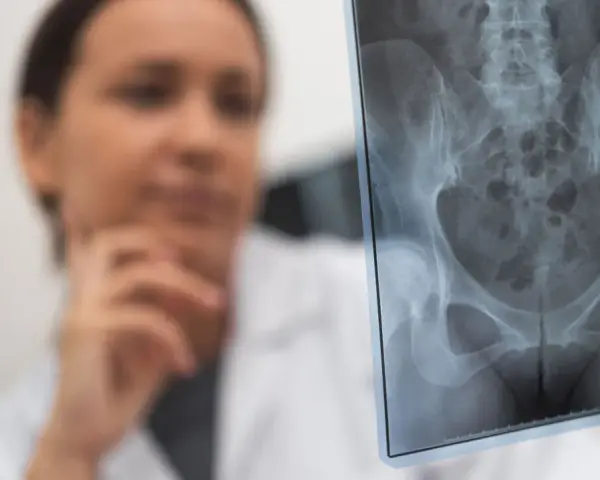 Lekarka analizuje RTG miednicy, szukając śladów stłuczenia biodra po upadku.