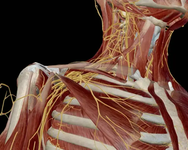 Anatomical view of the shoulder and neck, highlighting the complex network of nerves. This visualization helps understand the potential for uszkodzenie splotu ramiennego.