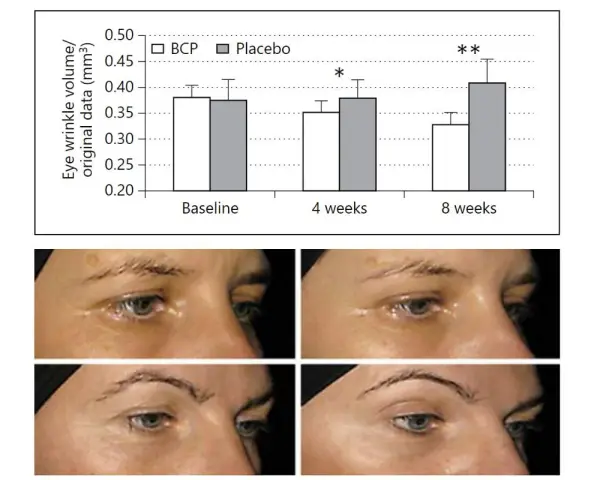Wykres i zdjęcia pokazują redukcję zmarszczek wokół oczu po 8 tygodniach stosowania premium collagen 5000.
