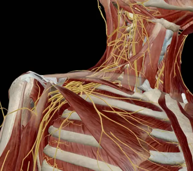 Anatomical view of the shoulder and neck, highlighting the complex network of nerves. This visualization helps understand the potential for uszkodzenie splotu ramiennego.
