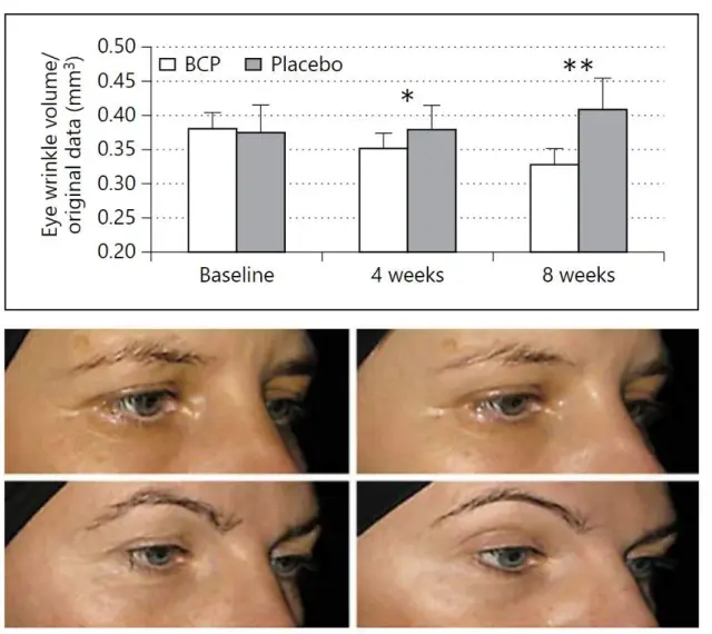Wykres i zdjęcia pokazują redukcję zmarszczek wokół oczu po 8 tygodniach stosowania premium collagen 5000.