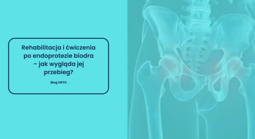Kiedy rehabilitacja po endoprotezie kolana? Pełny plan powrotu!