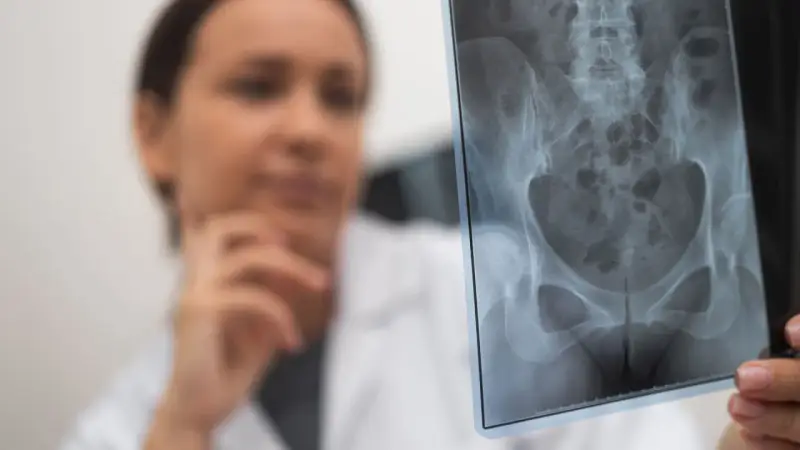 Lekarka analizuje RTG miednicy, szukając śladów stłuczenia biodra po upadku.